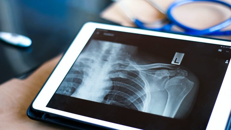 doctor use smart device for view x-ray image